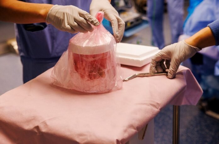 Rim de porco falha antes de transplante recorde nos EUA